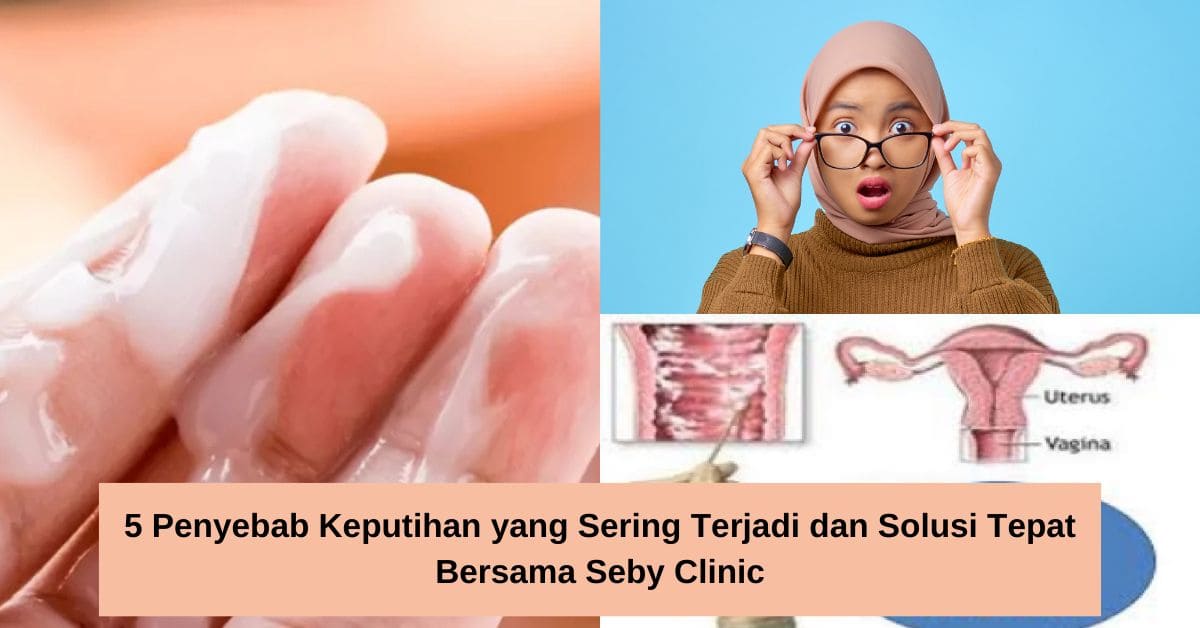 5 Penyebab Keputihan yang Sering Terjadi dan Solusi Tepat Bersama Seby Clinic