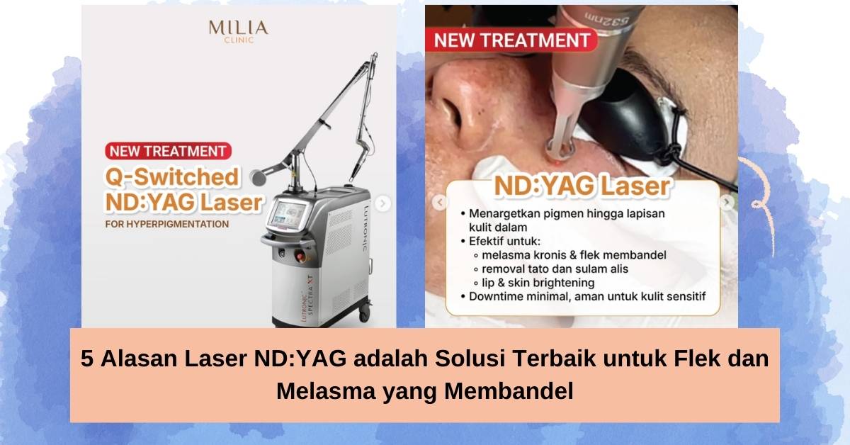 5 Alasan Laser ND:YAG adalah Solusi Terbaik untuk Flek dan Melasma yang Membandel