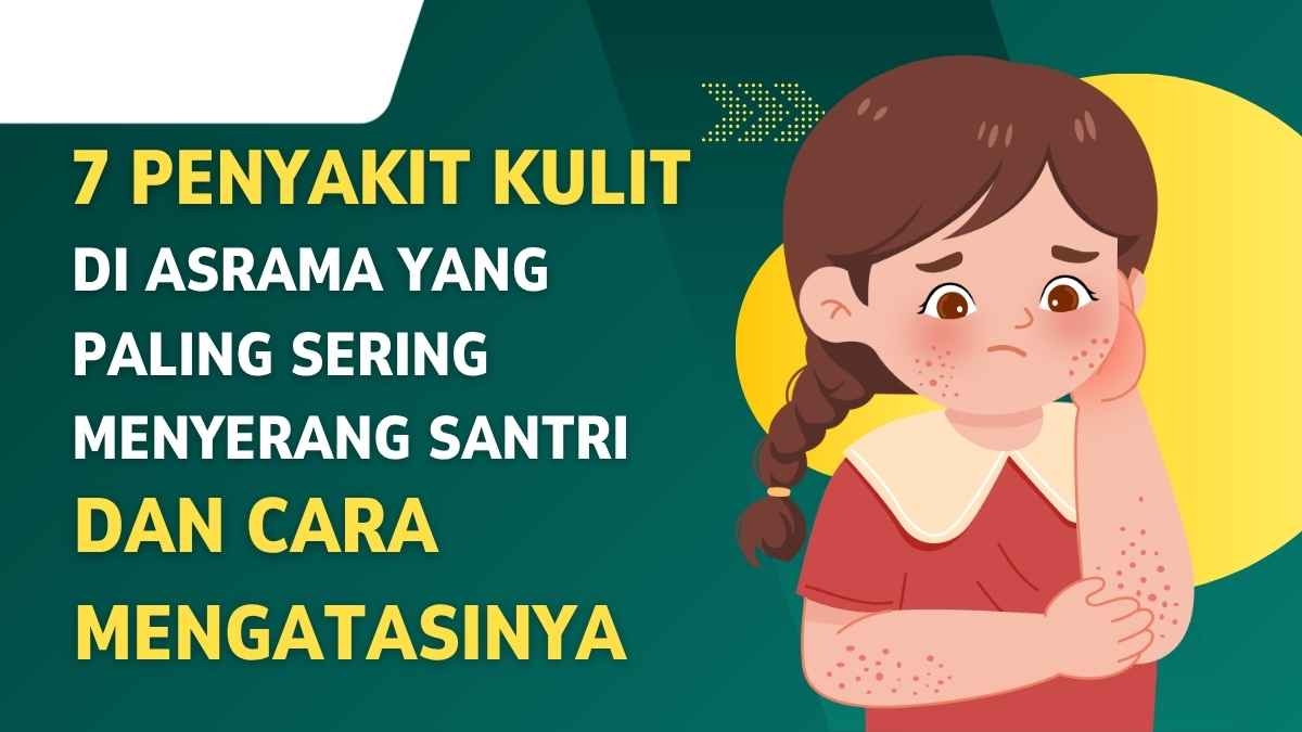 7 Penyakit Kulit di Asrama yang Paling Sering Menyerang Santri dan Cara Mengatasinya
