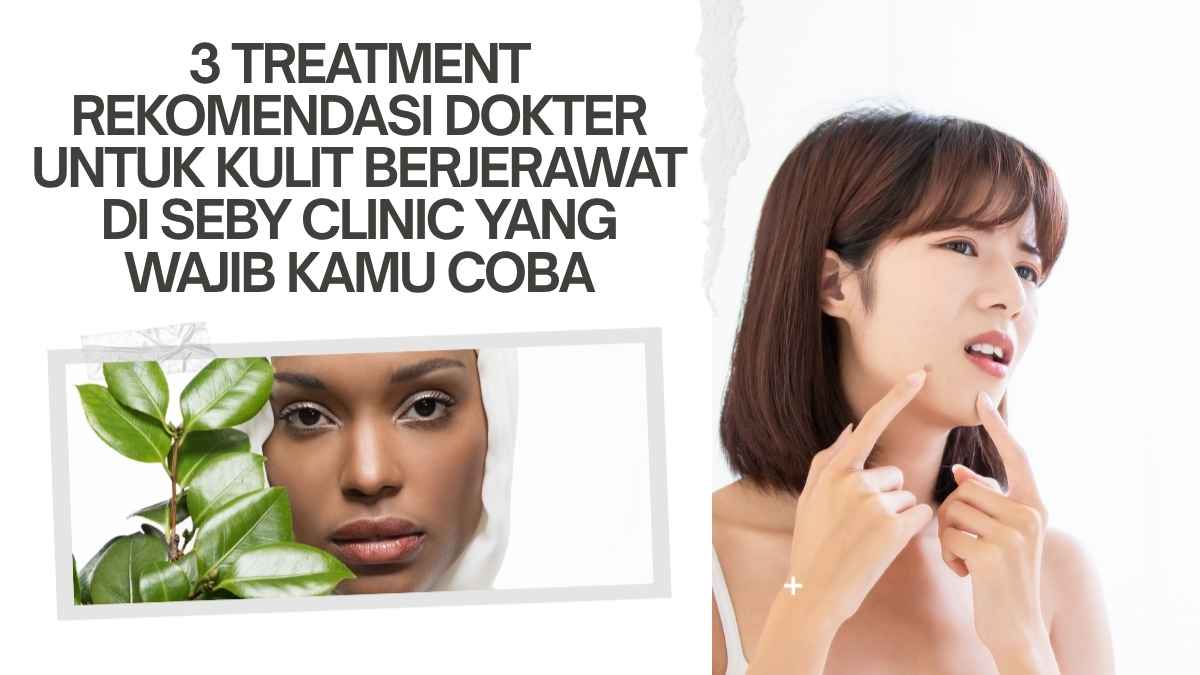 3 Treatment Rekomendasi Dokter untuk Kulit Berjerawat di Seby Clinic yang Wajib Kamu Coba