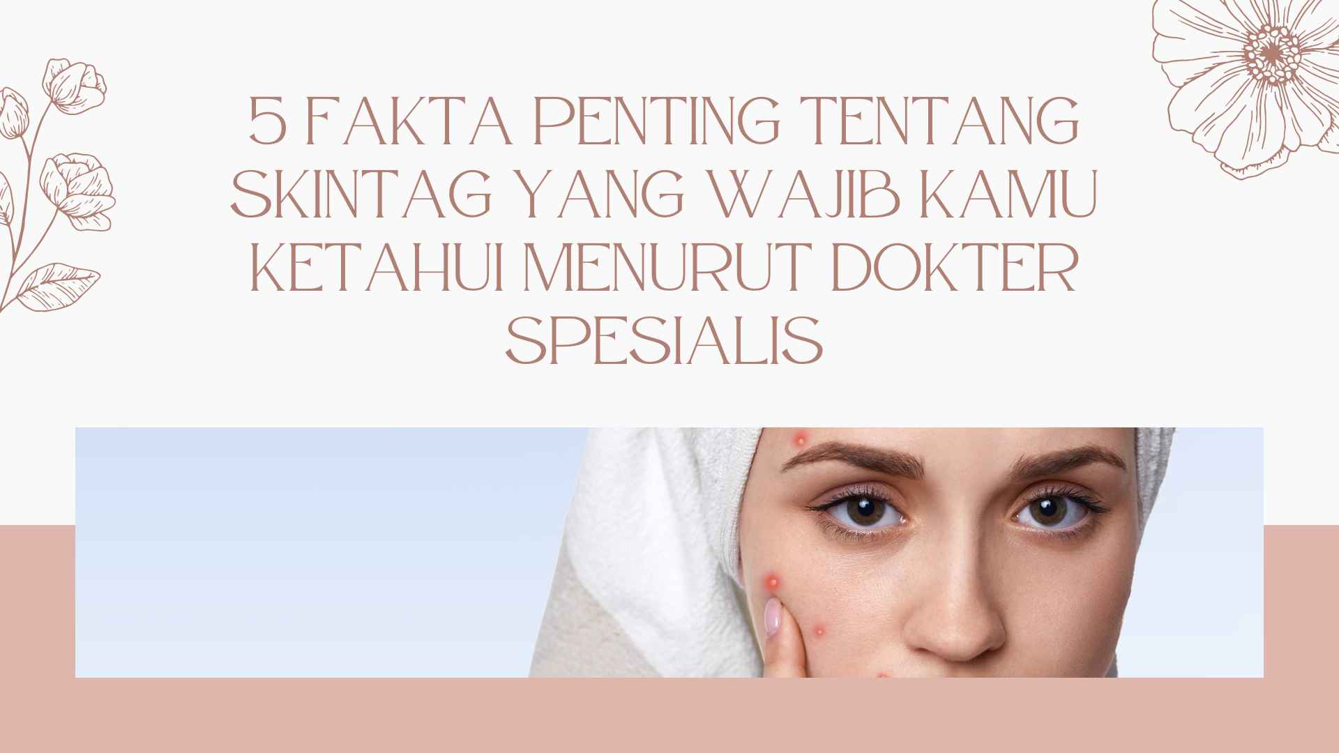 5 Fakta Penting Tentang Skintag yang Wajib Kamu Ketahui Menurut Dokter Spesialis